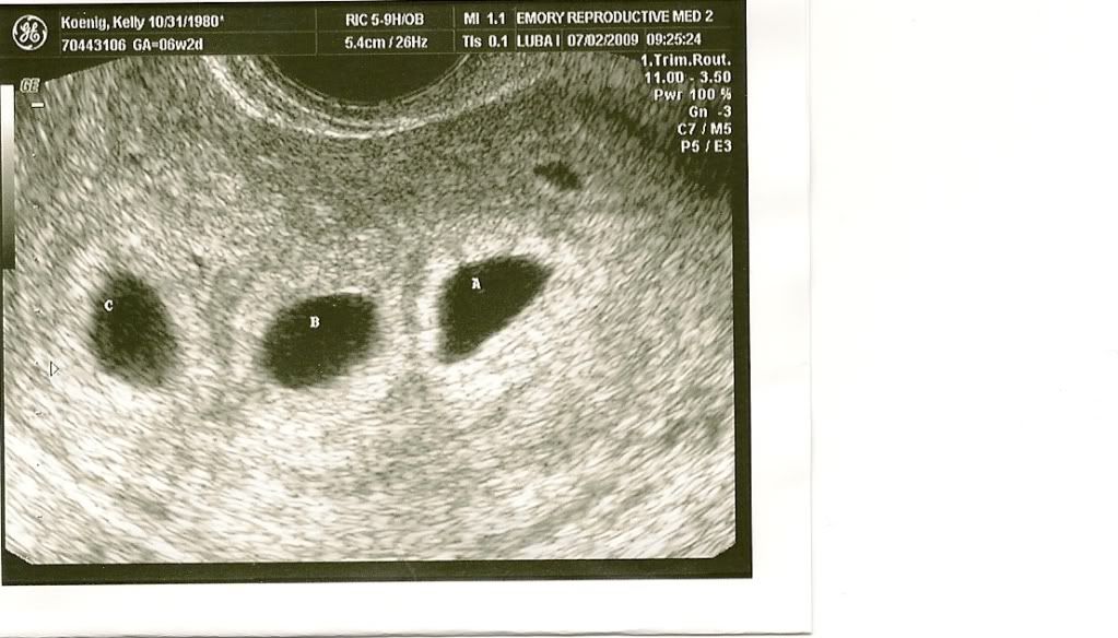 Triplets Scan